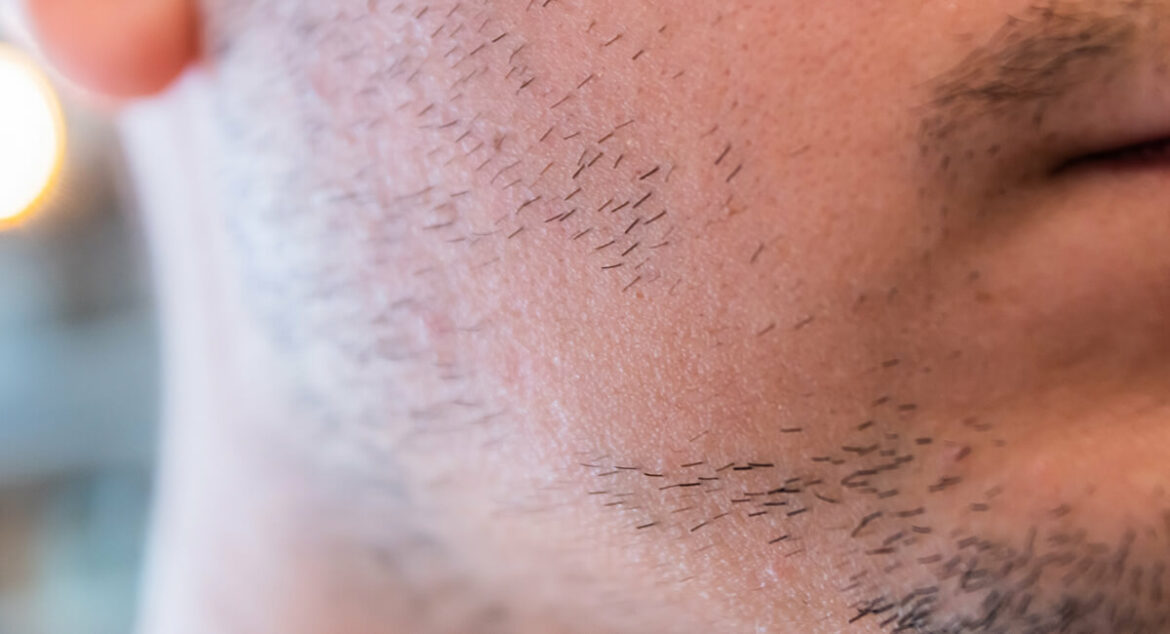 Comment aller à la Table ronde Elden Ring ?